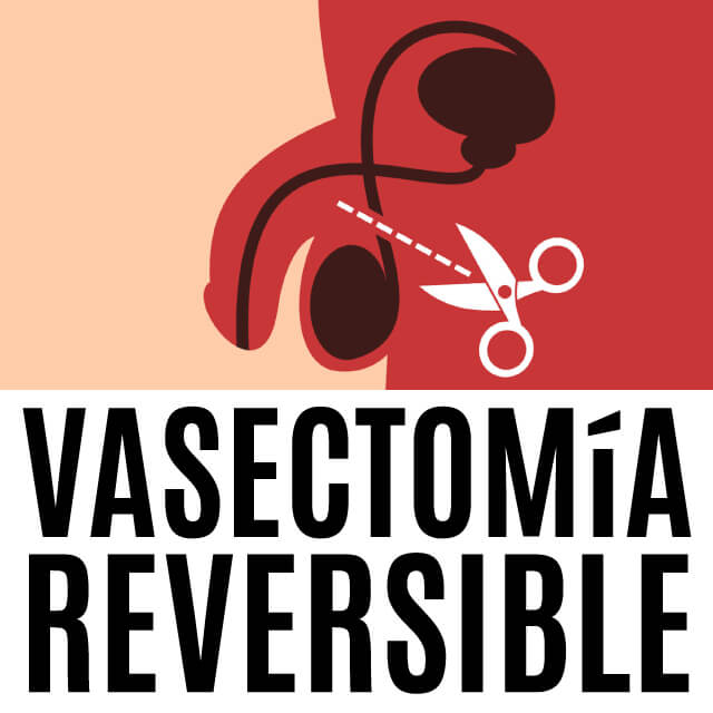 vasectomia reversible cdmx