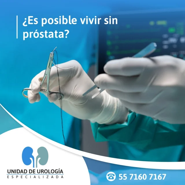 ¿Es posible vivir sin próstata?
 
Se le conoce como Prostatectomía al procedimiento quirúrgico que consiste en extraer la glándula prostática de manera parcial o total, siendo que es posible vivir sin la presencia de este tejido en el organismo.
 
Al retirar la próstata es posible que se produzca una incontinencia urinaria que suele tratarse con éxito en la mayoría de los casos, otra de las consecuencias de este procedimiento es la pérdida de la posibilidad de eyacular, sin embargo, no desaparece la sensación de placer.
 

Consulta a nuestros especialistas
ＣＩＴＡＳ
Teléfono: 55 7160 7167
WhatsApp: 55 2469 9630
Urgencias 24 hrs: 55 1204 5618 
https://urologos.doctor/
.
.
.
.
.
#urología #urólogo #urólogocdmx #saludsexual #yomecuido #saludparatodos #saludmasculina #prevención #prevenir #datosmedicos #tipsmedicos #consejos #vph #ets #cancer #Cancerdeprostata
